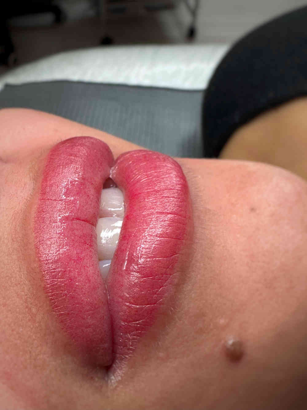 Candy Lips