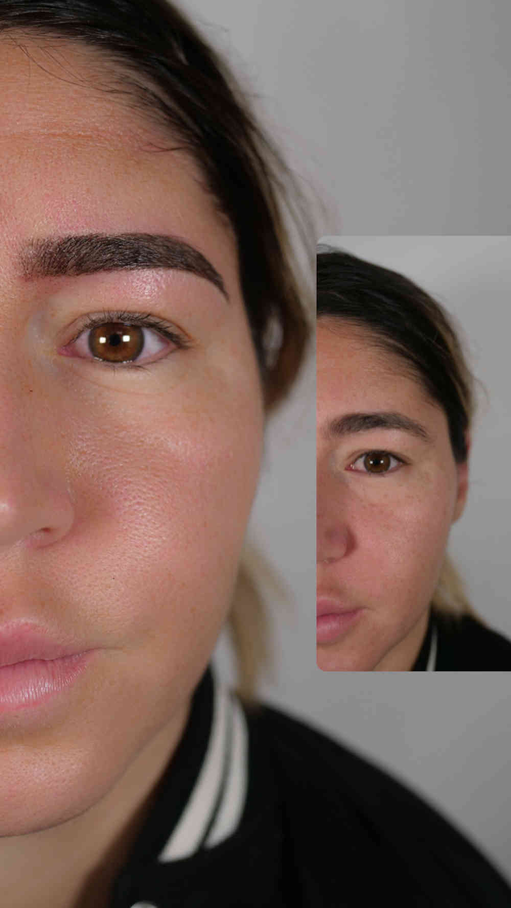 Microshading